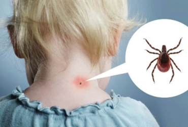 Как защитить детей от клещей
